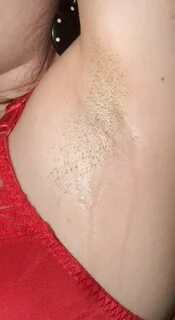 Under boobs amd armpits smell like yeast infection