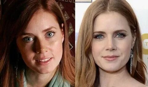 Amy Adams Plastic Surgery for more beautiful face?