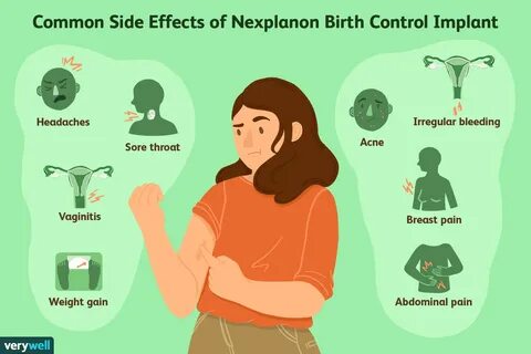 Common side effects of nexplanon birth control implant. 