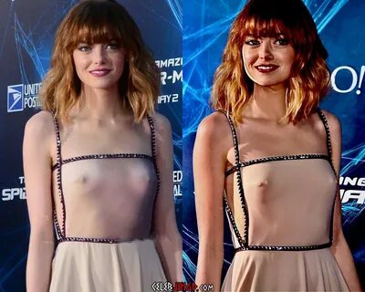 Emma Stone’s Hard Nipples And Shocking Weight Gain - The Fap