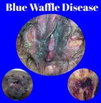 Blue Waffle Disease Meme - Captions Trend
