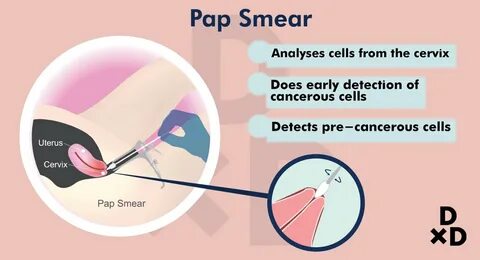 26+ Pap Smear Test - Gordon Gallery