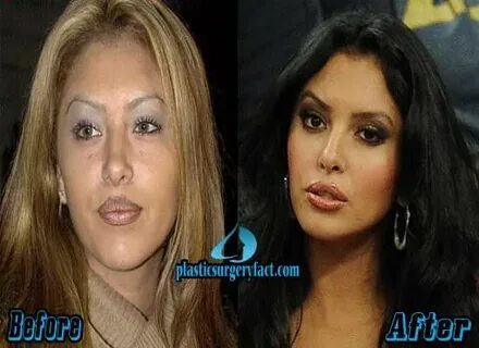 Vanessa Bryant Plastic Surgery Before and After Pictures Van