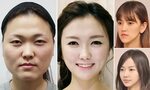 Plastic surgery in South Korea is so good people are unrecog