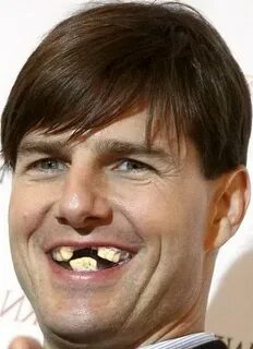 Tom Cruise Teeth Mild Holoprosencephaly : Tom Cruise Front T