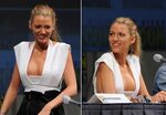Blake Lively’s Busting Breast Implants! Celebrity Plastic Su
