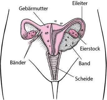 Endometriose - Gesundheitsprobleme von Frauen - MSD Manual A