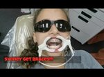 SYDNEY GETS BRACES!! - YouTube