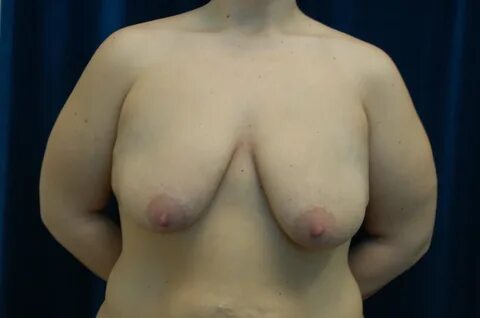 Realelders.com : Ugly Floppy Lopsided Boobs - Ugly Floppy Lopsided Boobs 27...