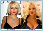 Christina Aguilera before and after plastic surgery - Plasti