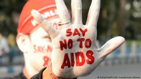 hiv aids images
