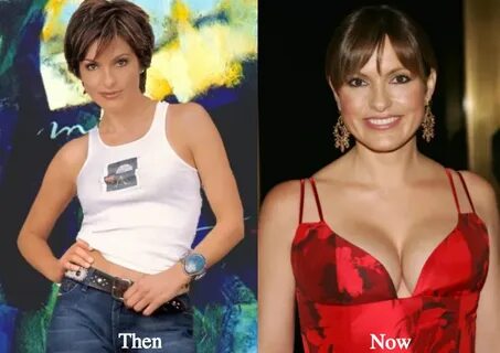 mariska-hargitay-breast-augmentation-before-and-after - Late