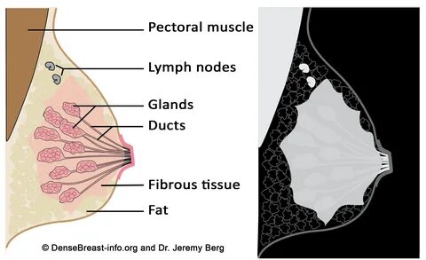 Are boobs just fat or breast tissue