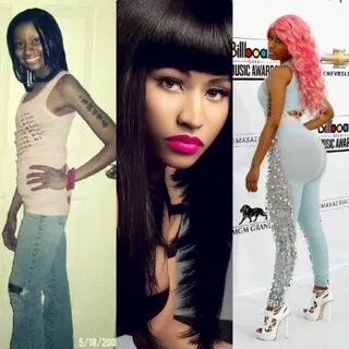 Just look under "Nicki Minaj Plastic Surgery before and afte