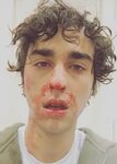 Alex-Wolff-in-an-Instagram-selfie-in-May-2017 Celebs, Height