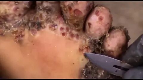 Anna's Jigger Popping (Part Two) - NSFW Pops & Removal! - Yo