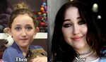 Noah Cyrus Plastic Surgery Before and After Photos - Latest 