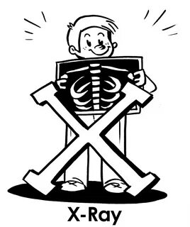x is for x ray - Clip Art Library