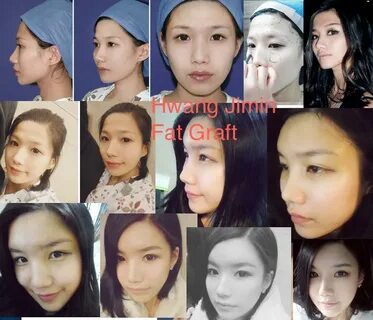 Chungdam U Plastic Surgery & Skin PurseForum
