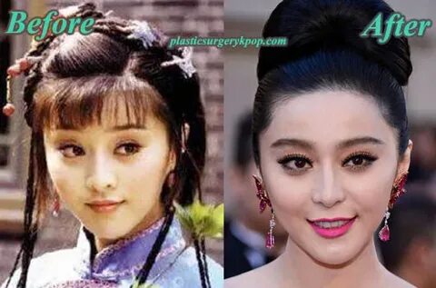 Fan Bingbing Plastic Surgery Before & After Pictures