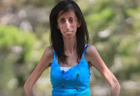 Bullies Called Her "The World's Ugliest Girl". Now Her React