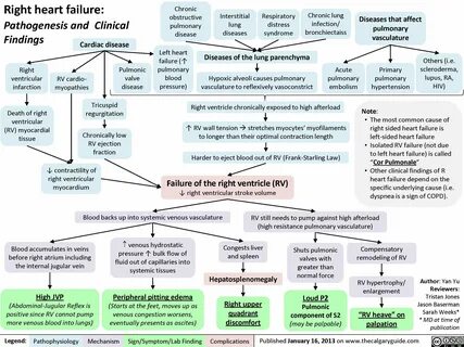 Right Heart Failure Calgary Guide Pathophysiology nursing, E