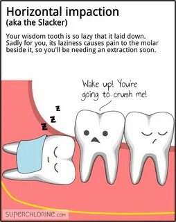 Wisdom teeth personalities Wisdom teeth, Dental fun, Teeth h