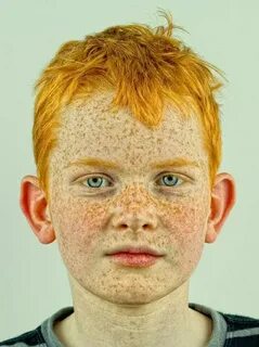 Ugly Ginger Kid - Фото база