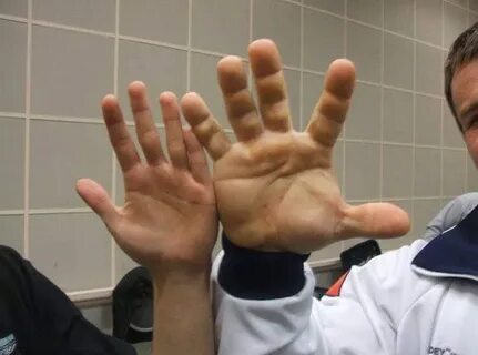 Hand of a Ukrainian World Champion in Arm Wrestling Denis Ts