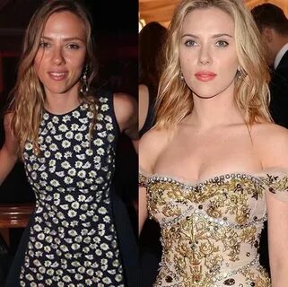 Scarlett Johansson Breast Implants Removed - CELEB-SURGERY.C