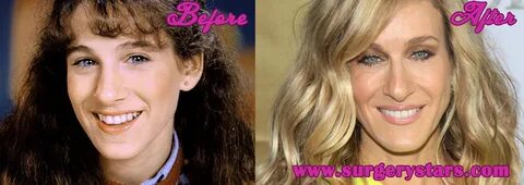 Sarah Jessica Parker Plastic Surgery Pictures