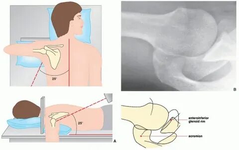 Upper Limb I: Shoulder Girdle Radiology Key