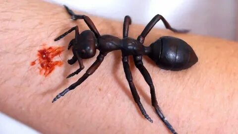 GIANT ANT BITE! - YouTube