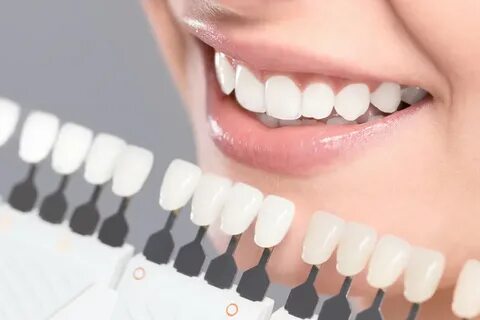 Premium Zahnersatz I Dentales Fräszentrum CAD/CAM I Dentalla