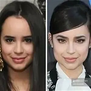 Perfil de Sofia Carson plastic surgeries (@sofiacarsonplasticsurgery) en In...