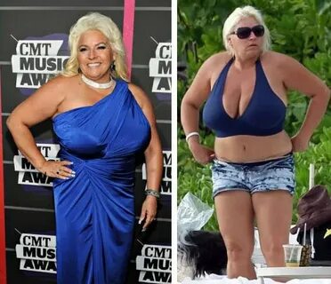 Beth Chapman Plastic Surgery - Boob Job & Liposuction - Plas