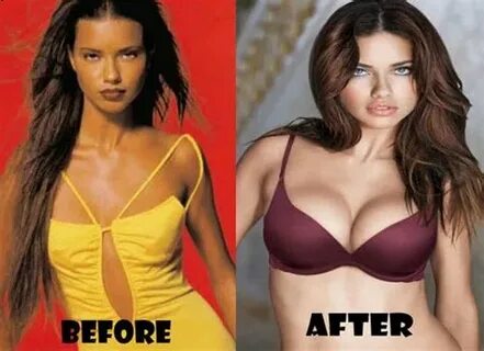 Adriana Lima Plastic Surgery Before And After Celeb Free Dow