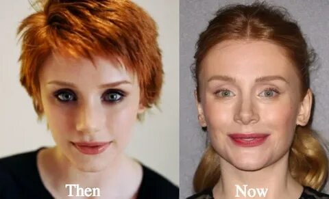 Bryce Dallas Howard Plastic Surgery Before and After Photos 