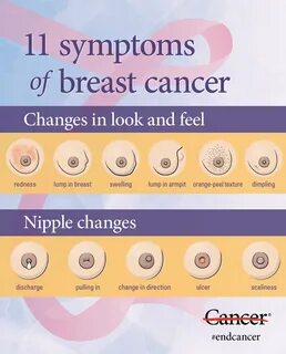 MD Anderson Cancer Center в Твиттере: "Do you know the signs