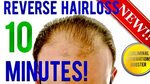 🎧 REVERSE HAIR LOSS IN 10 MINUTES!! SUBLIMINAL AFFIRMATIONS 