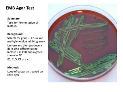 PPT - Summary of Biochemical Tests in Microbiology PowerPoin