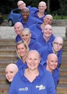 Bald women pose for nude calendar raising funds for Alopecia