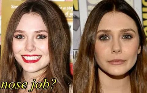 Elizabeth Olsen Nose Job Before and After, Plastic Surgery F