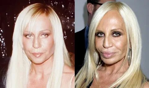 duş Şehir çiçek Ayıkla donatella versace before kavga Alerji