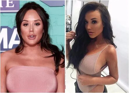 Charlotte Crosby Shows Off The Results Of New Boob Job After