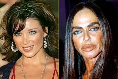 michaela-romanini-plastic-surgery-before-and-after - Viral N