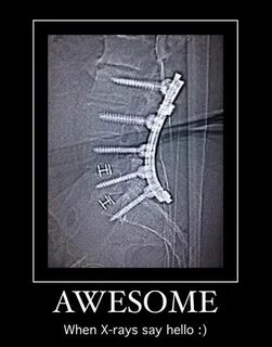 Pin by Sharla Graham on X ray Radiology humor, Radiology, Me