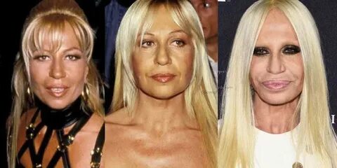 Donatella Versace Plastic Surgery Before and After Pictures 
