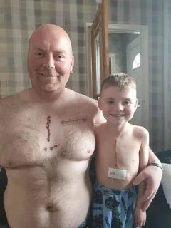 Joey 6 had life saving open heart surgery, Leeds uk. Dad got