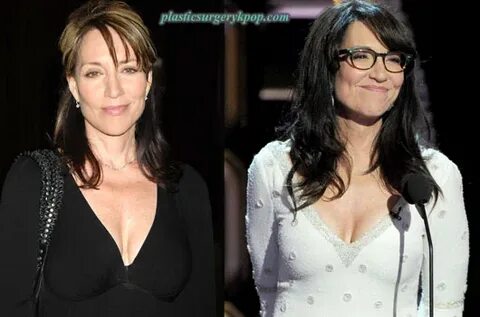 Katey Sagal Plastic Surgery Facelift, Botox Before and After